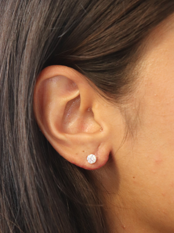 Earlobe Repair