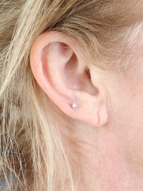 Earlobe Repair Before & After Gallery - Patient 424135 - Image 3