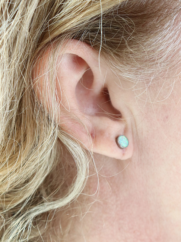 Earlobe Repair Before & After Gallery - Patient 424135 - Image 4