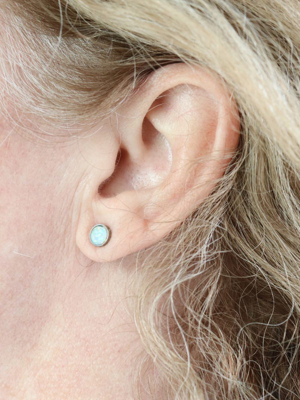 Earlobe Repair Before & After Gallery - Patient 424135 - Image 2